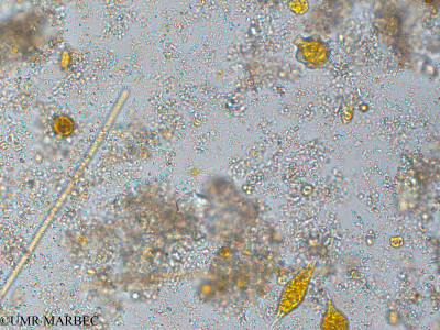 phyto/Pertuis Charentais/Tasdon_st7/PAMPAS 2019-2021/Chodatella sp (TASDON_St7_0419-013).tif(copy)_thumb.jpg